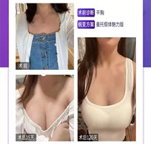 北京米蘭柏羽麗都隆胸價(jià)格1.9-18萬起，高超ω動(dòng)態(tài)豐胸術(shù)手感更真實(shí)