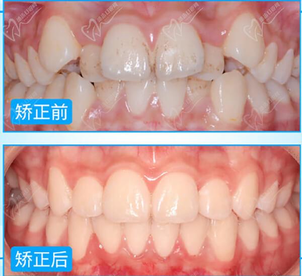 西安畫(huà)美口腔2021特惠專場(chǎng)