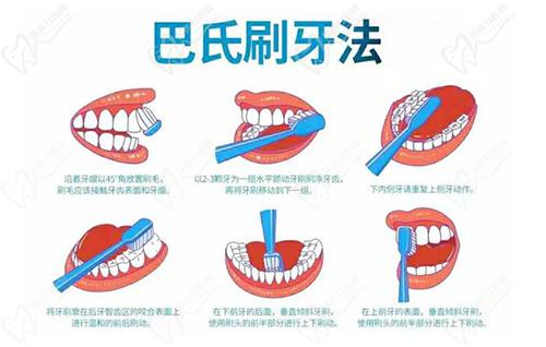 巴氏刷牙法