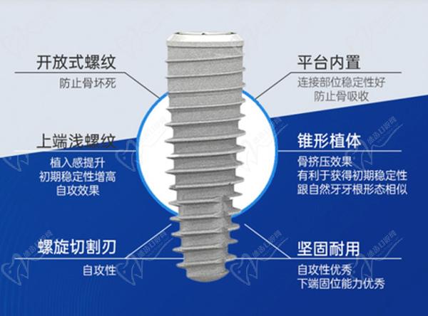 成都中諾口腔醫(yī)院種植牙多少錢