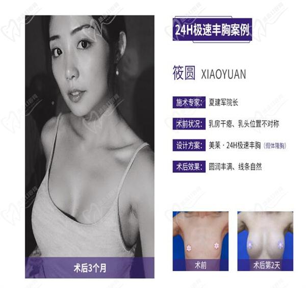 南京夏建軍和黃名斗哪個(gè)技術(shù)好