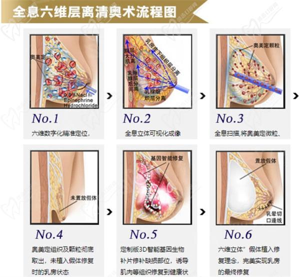 全息六維層離清奧術(shù)