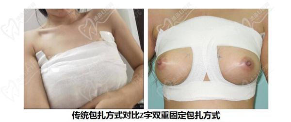 李高峰隆胸圖片