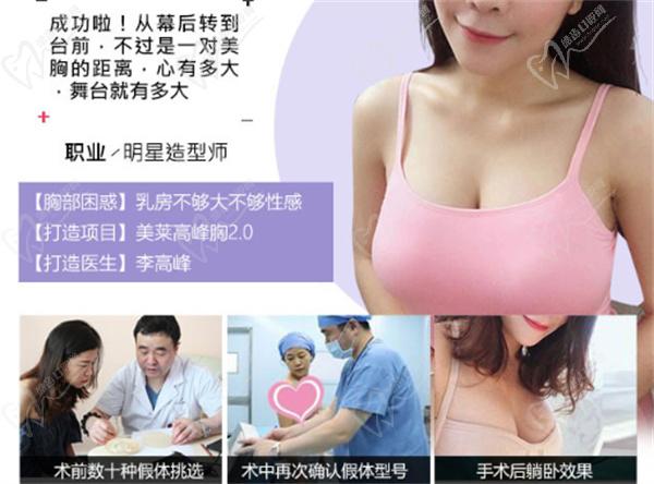 李高峰隆胸案 例