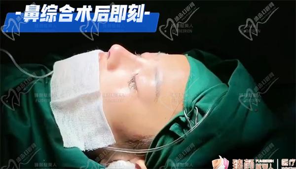 鄭州臻顏池凱隆鼻手術(shù)圖片