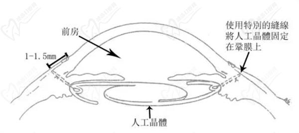 人工晶體