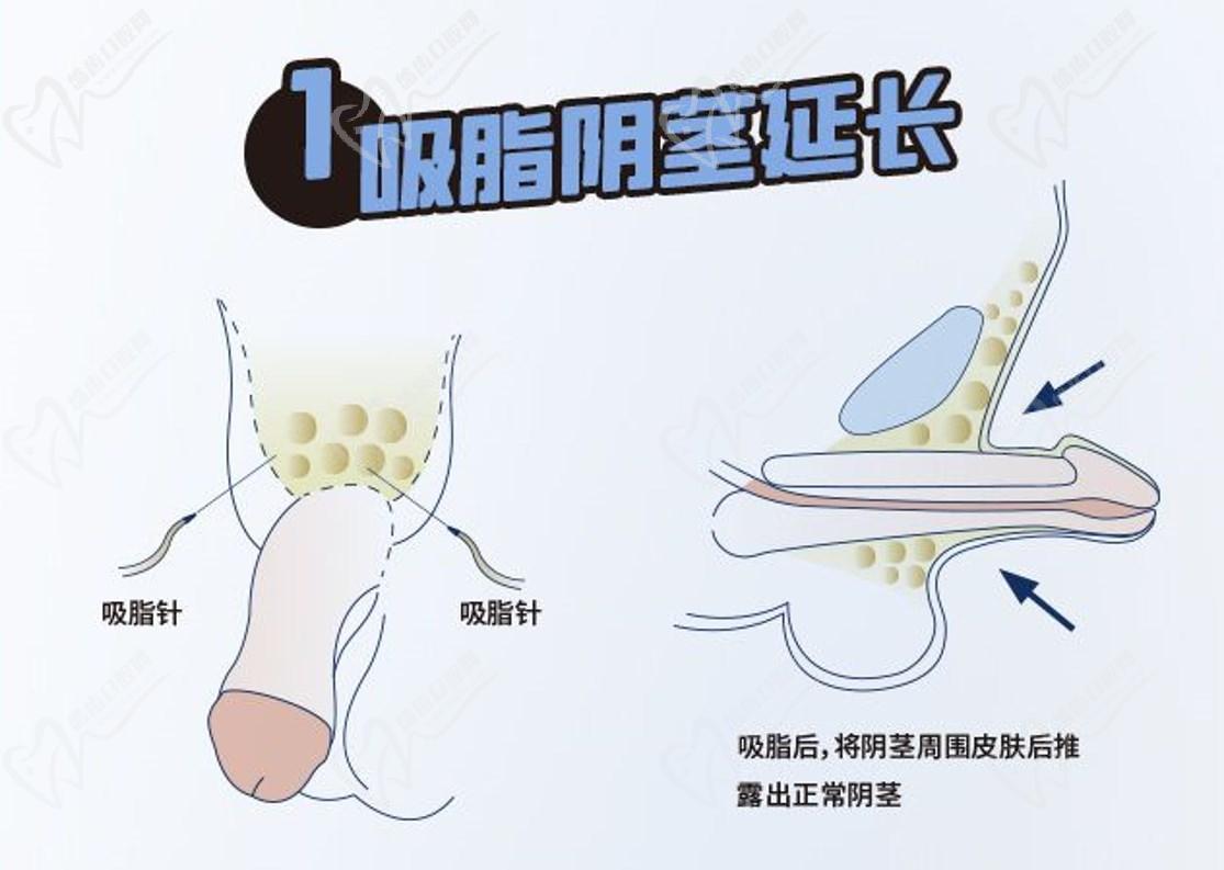 李世榮醫(yī)生靠譜嗎