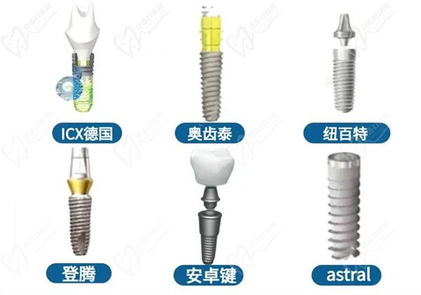 種植牙齒哪個品牌好