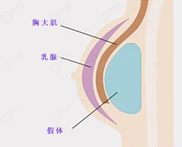 隆胸預(yù)約網(wǎng)上報(bào)名