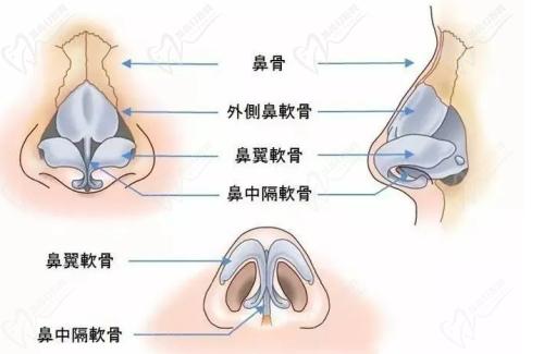 武漢中翰整形付毅醫(yī)生做鼻子口碑不錯(cuò)