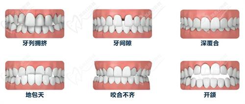 溫州樂清齒逸口腔矯正牙齒靠譜嗎