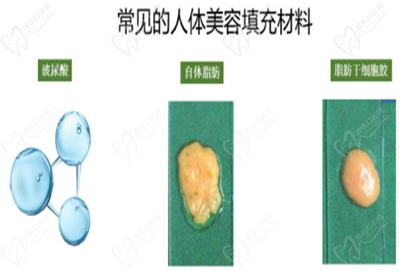 深圳脂肪填充好的醫(yī)生是哪家