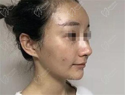不同地區(qū)的消費(fèi)水平和市場(chǎng)供需情況不同，這對(duì)艾薇嵐童顏針的價(jià)格影響較大。