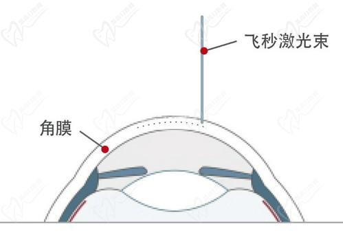 王曉瑛醫(yī)生在哪里出診？上海普瑞、上海和平等眼科醫(yī)院可預(yù)約