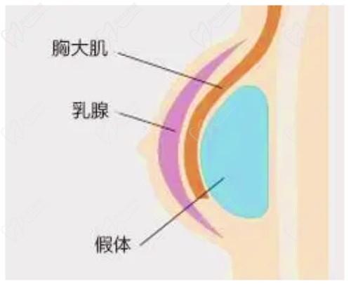 米蘭柏羽開啟胸部醫(yī)生面診日，穆大力、李英大親診做出精致自然美胸